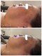 private salon KANASAの写真/フェイスラインのもたつきを撃退して引き締まった上向き小顔へ☆自信の表情