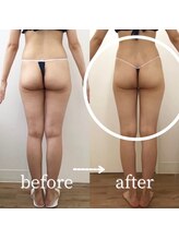 ボーレーヴ(beau reve)/ブライダル/インディバ/痩身