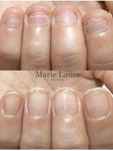 マリーロール 天王寺店(Marie Laure)/自爪育成/深爪矯正/ネイルケア