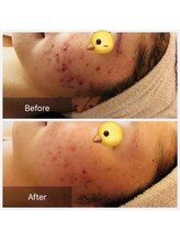 ユー(U)/お肌の悩み