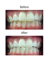 ニコ 西葛西店(nico)/ビフォーアフター2