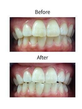 ニコ 西葛西店(nico)/ビフォーアフター2