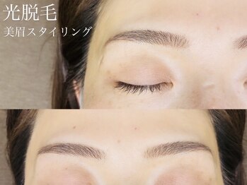 リノモア(LinoMoa)の写真/痛みが少ない光脱毛で理想の美眉へ！ワックス不要の眉スタイリング◆顔の骨格に合わせてご提案◎【蒲田】