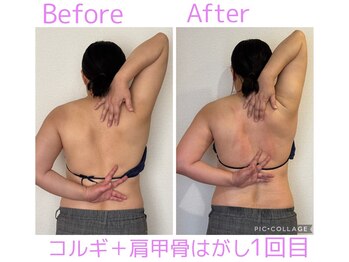 ルル(Ruru)/肩甲骨はがし/1回目