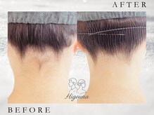 エープラス 心斎橋店(A+)/ひげうな脱毛