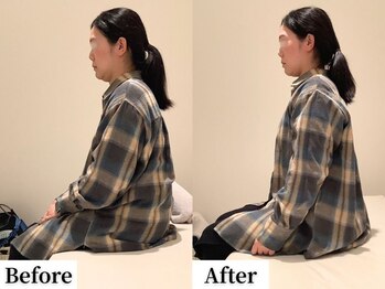 ソレア(Solea)/肩こり改善1回目