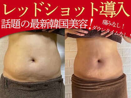 エステティック リオン(Rion)の写真