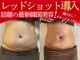 エステティック リオン(Rion)の写真