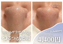 ラノン(Ranon)