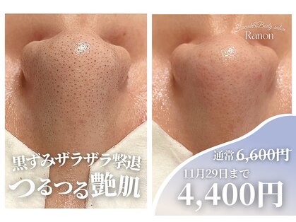 ラノン(Ranon)の写真