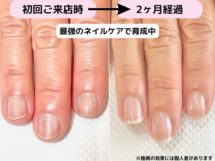 カピリナ(Ka Pilina)の写真