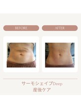 ユウキ(yuuki)/サーモシェイプDeep産後ケア