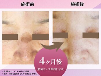 花蔵 浦和コルソ店