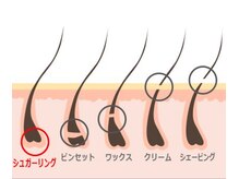 ワックス脱毛、シュガーリング脱毛 即効できる脱毛方法で同じすが、やり方が少し異なります。