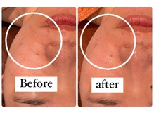 サロンドフェイス 木曽川店(Salon de Faith)の雰囲気(肌質改善♪)