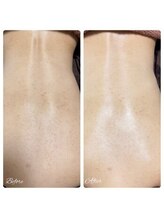 シャナ(Shana)/背中カーボキシー