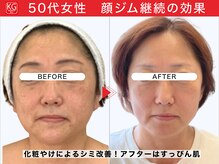 顔ジム 麻布店/50代女性顔ジム継続の効果