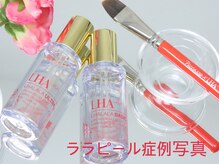 リクラ 北千住(Reclat)/ララピール症例写真↓