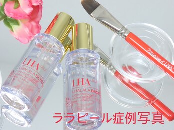 リクラ 北千住(Reclat)/ララピール症例写真↓