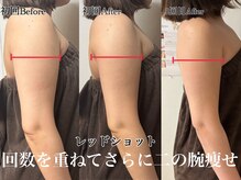アンドエス 六本木(and S.)/回数を重ねて二の腕スッキリ♪