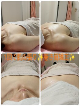 ブルーム 高崎(BLOOM)/バストケアで美肌巻き肩矯正も♪