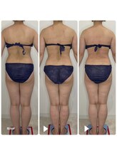 カプリス(CAPRiCE)/リンパドレナージュ