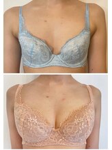 美人バスト 豊橋店/バストアップ症例【バストケア】