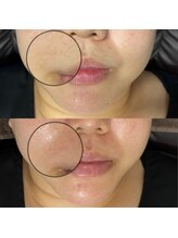 シェリートーキョー 成田店(Cherie Tokyo)/Before＆After /成田店