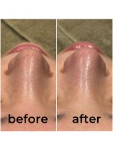 ラシンバン(Lashinvan)/ハイドロスプラッシュ