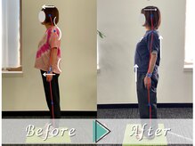 コグフィット/悩みの猫背が改善！