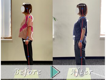 コグフィット/悩みの猫背が改善!