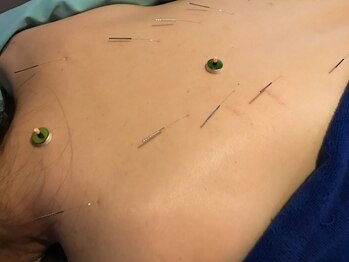 フィットジユウガオカ(Fit_Jiyugaoka)/自律神経不調は背中がポイント