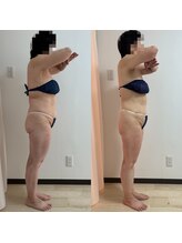 パピヨン(Papillon)/たるみなく綺麗にダイエット◎