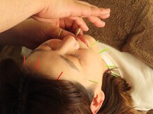 高橋整骨院鍼灸院/美容鍼