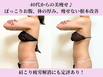リクラ(Reclat)の写真