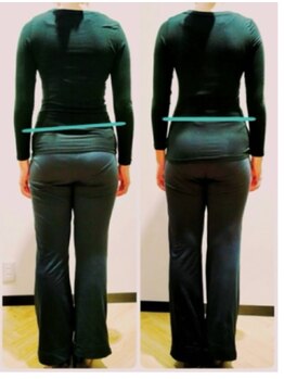 ア ニュームーン 京都烏丸店(a New Moon)/姿勢　骨格矯正ビフォーアフター