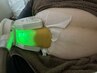 【冷却ダイエット】脂肪冷却でお腹をダイレクトケア！お得に同日２ヶ所可！