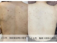 ラビエス(LAVIES)の雰囲気（【20代】背中が空いた服も自信をもって着る事ができるように☆☆）