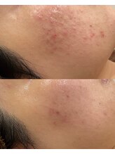 リヴェーヌ 呉羽店(Riverne)