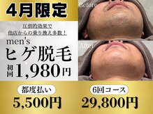 シェリエ(Sheller)