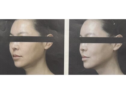 サロンつぼみの写真