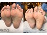 冬だからこそ！フットパドル角質ケア￥6.600
