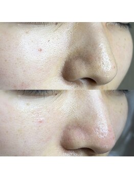 シャイニー(SHINY)/30代女性