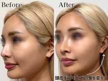 プルチャームエテルナ 代官山店(Pulchram eterna)/たるみの新常識！頭皮リフト