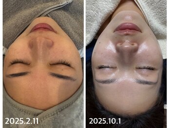 リノ(lino)/くすみ・シミ・毛穴レスに♪