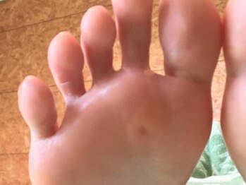 足トラブル専門店  フットケアサロン Nicolulu 春日部店【ニコルル】の写真/痛みを最小限に！古い角質を取り除くだけではなく【たこ・魚の目】も同時にケア☆肩コリ、腰痛改善も◎