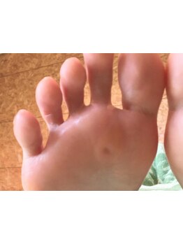 角質ケアができるサロン