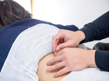 昭和鍼灸マッサージ　松戸店/