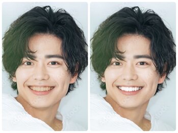 ホワイトニングショップ 長崎時津店/男性も白い歯で清潔感アップ♪