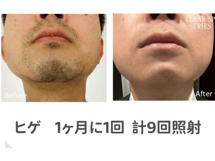 クリスタルハート(Crystal heart)の写真